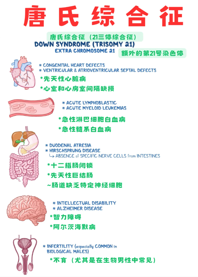 什么是唐氏症,都有那些特征