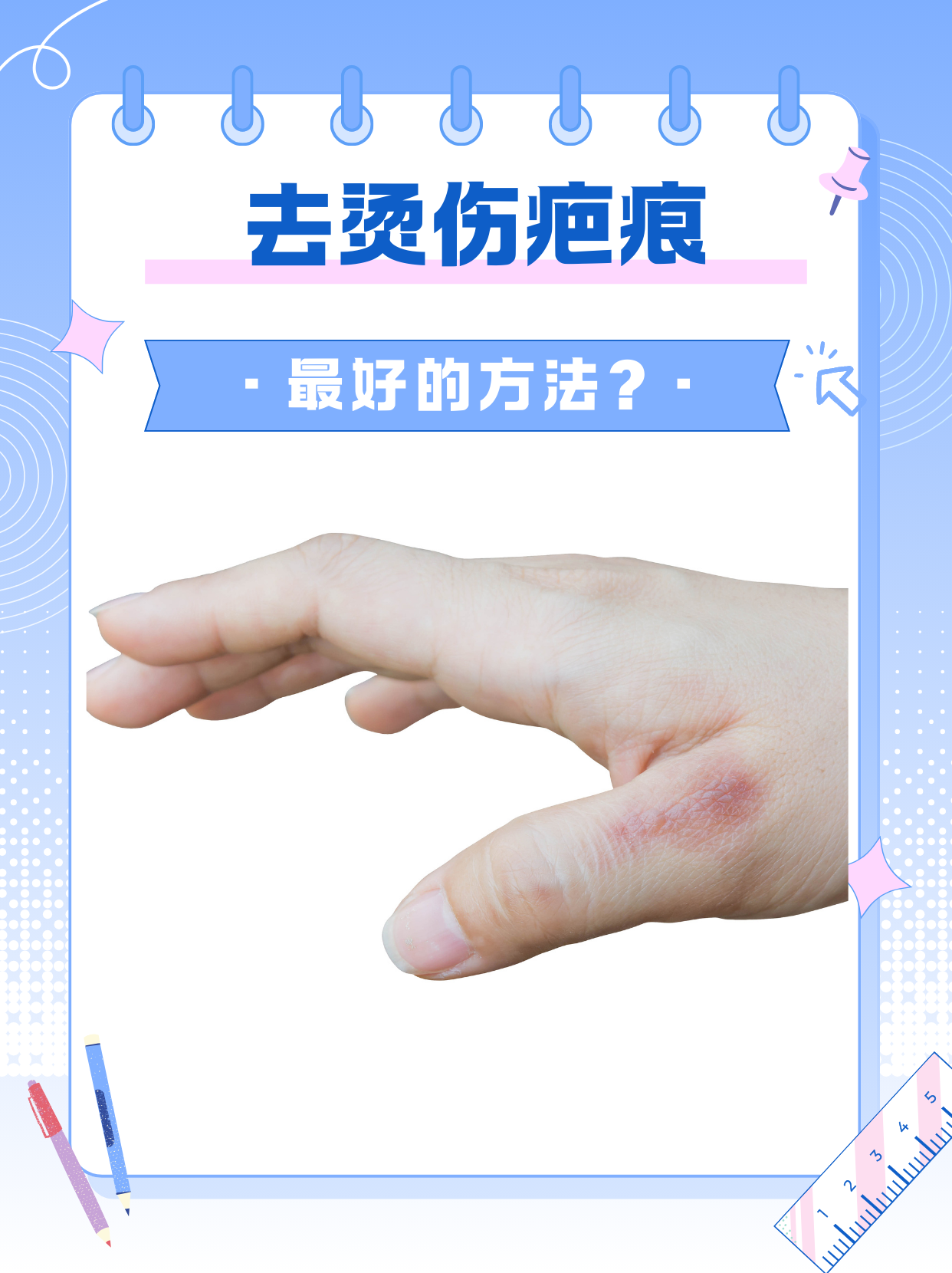 烫伤怎么治疗好得快