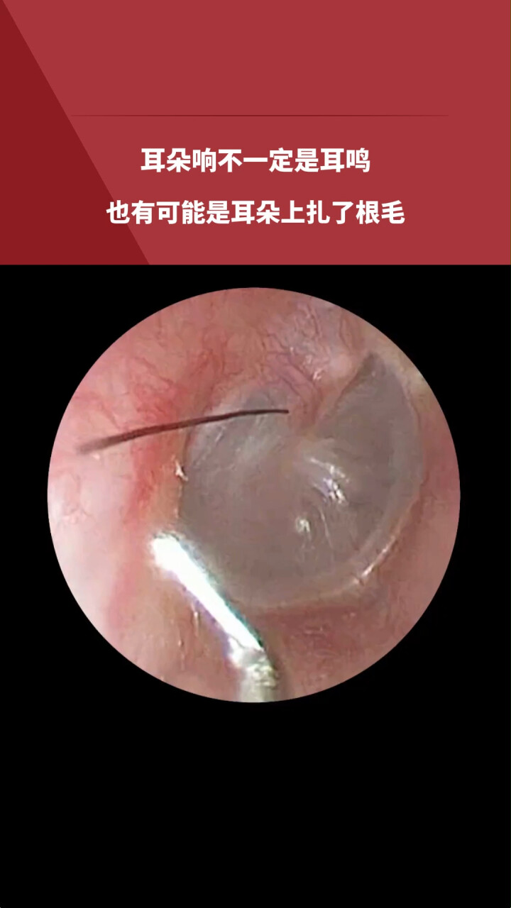 耳朵里面老是轰轰隆隆的响是怎么回事?