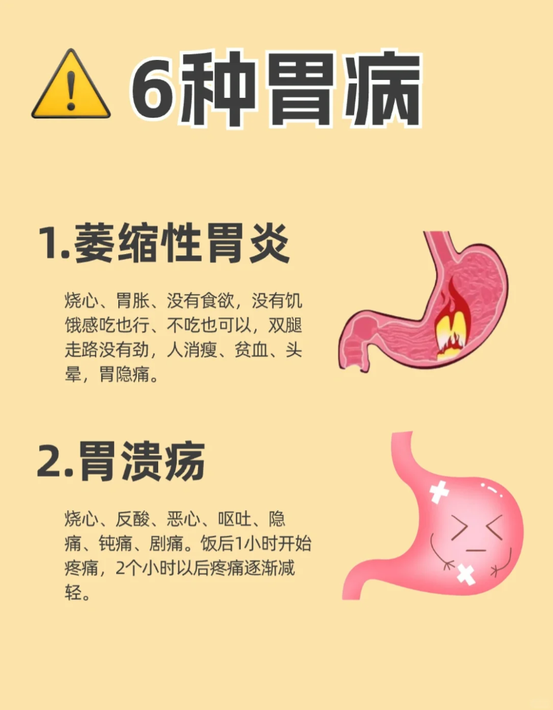 胃酸反流的症状有哪些