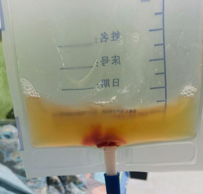 用佳茵每天排黄色液体常吗?