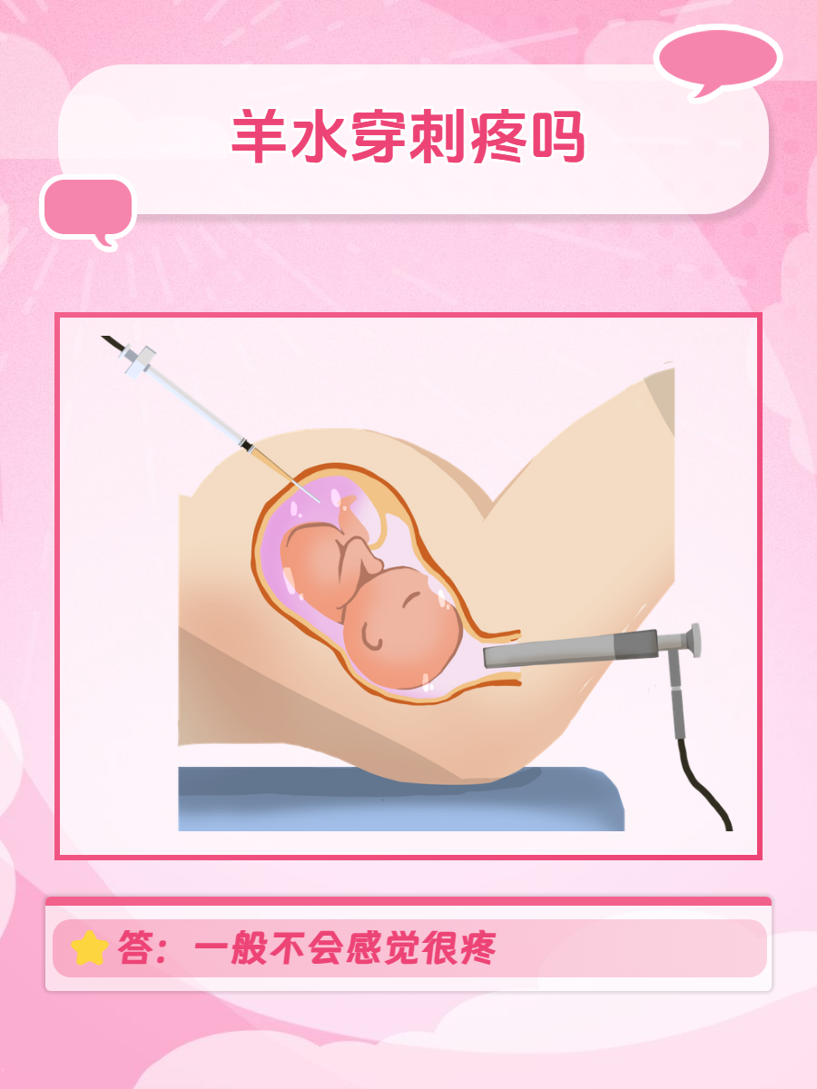 乳房穿刺活检是什么意思