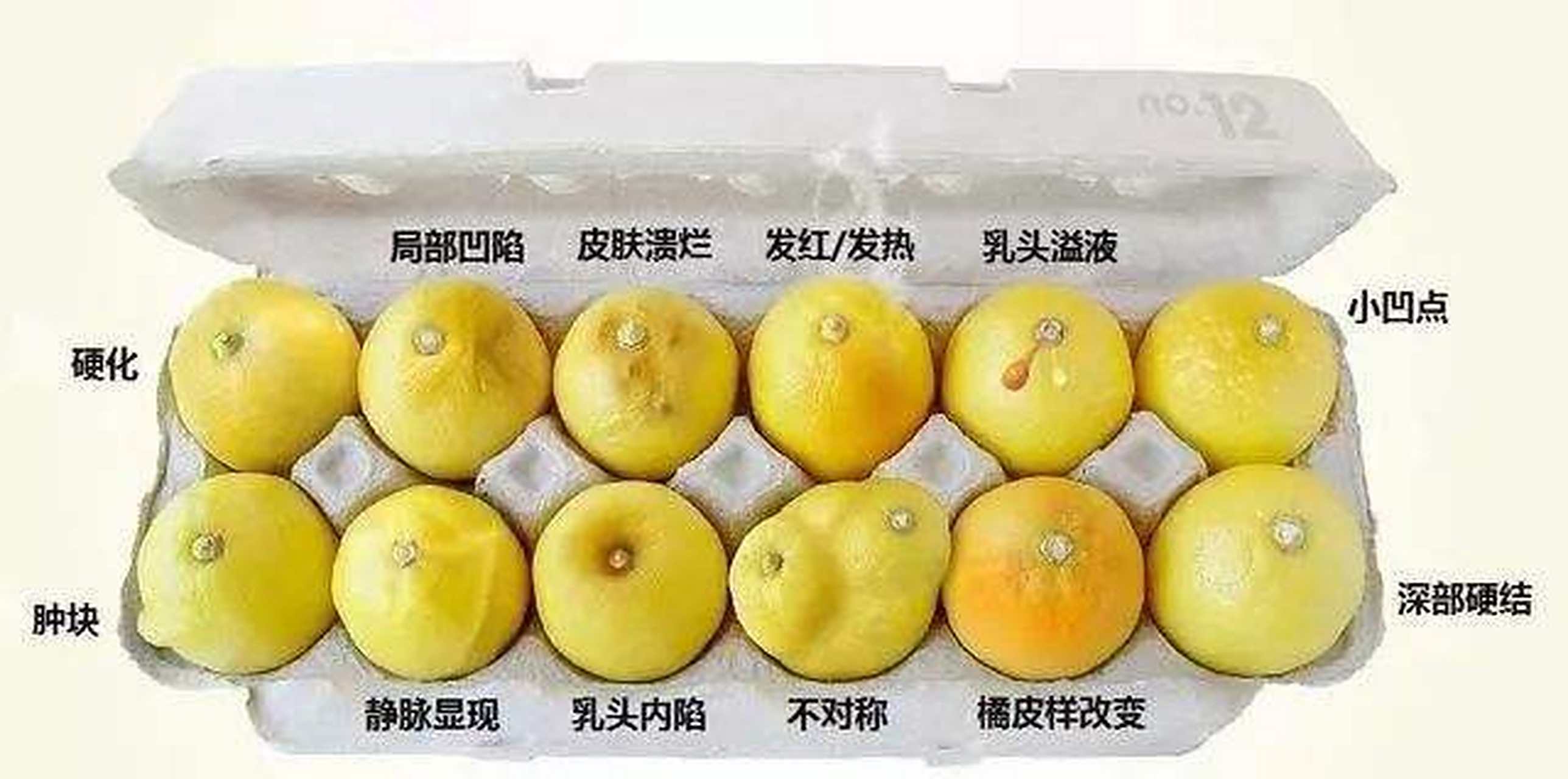 少女乳房里面有硬块