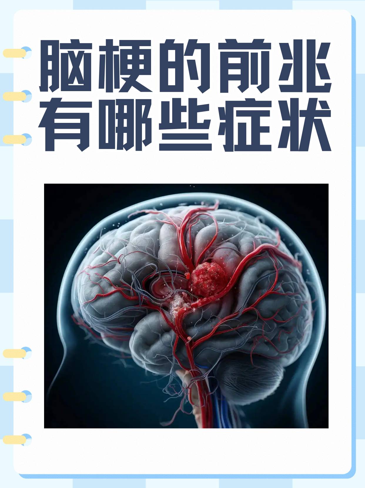 脑供血不足的症状表现