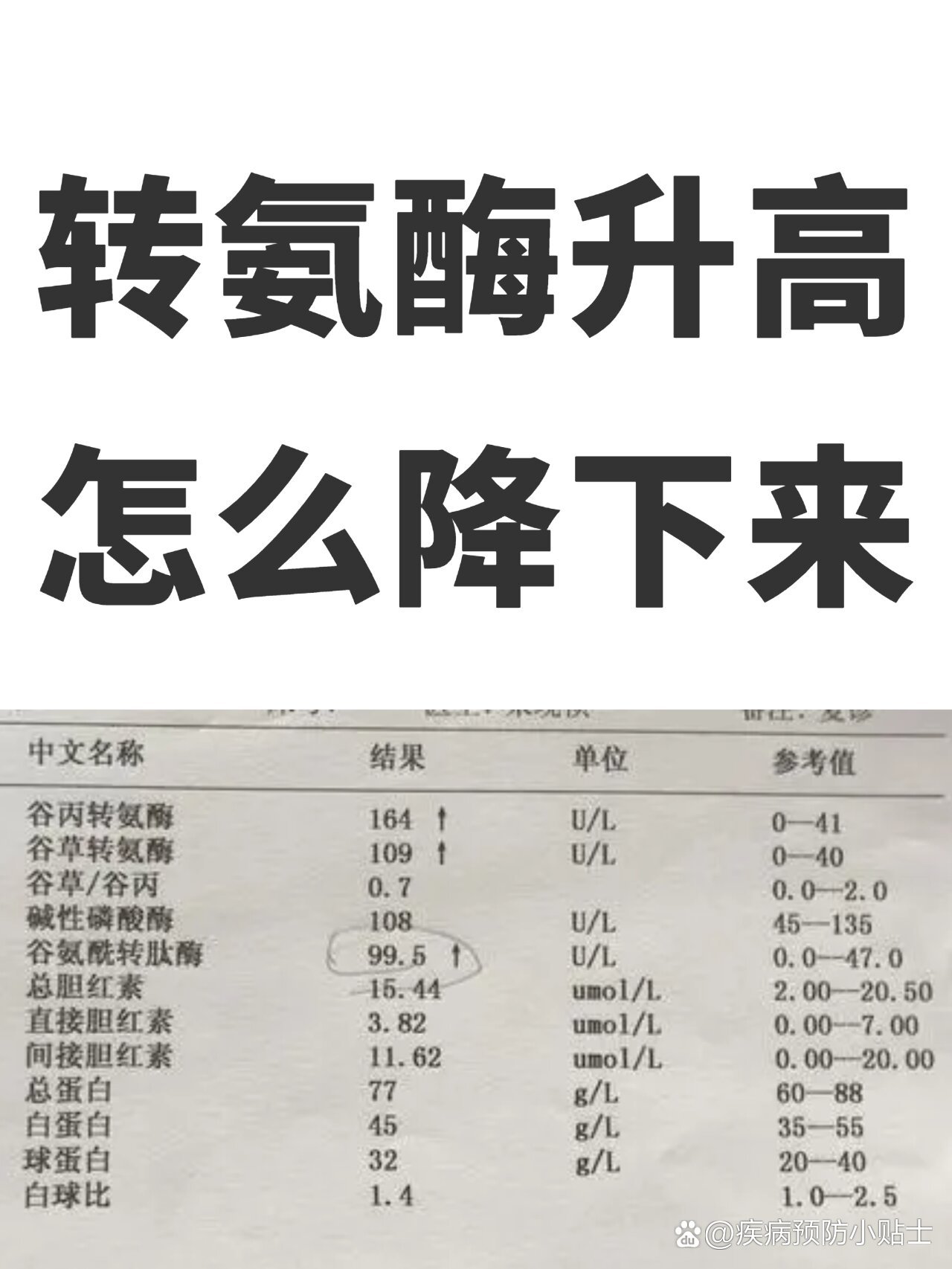 转氨酶值高,一直降不下来,怎么办?