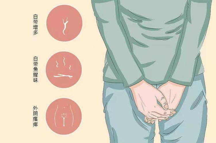 阴道炎哪些症状