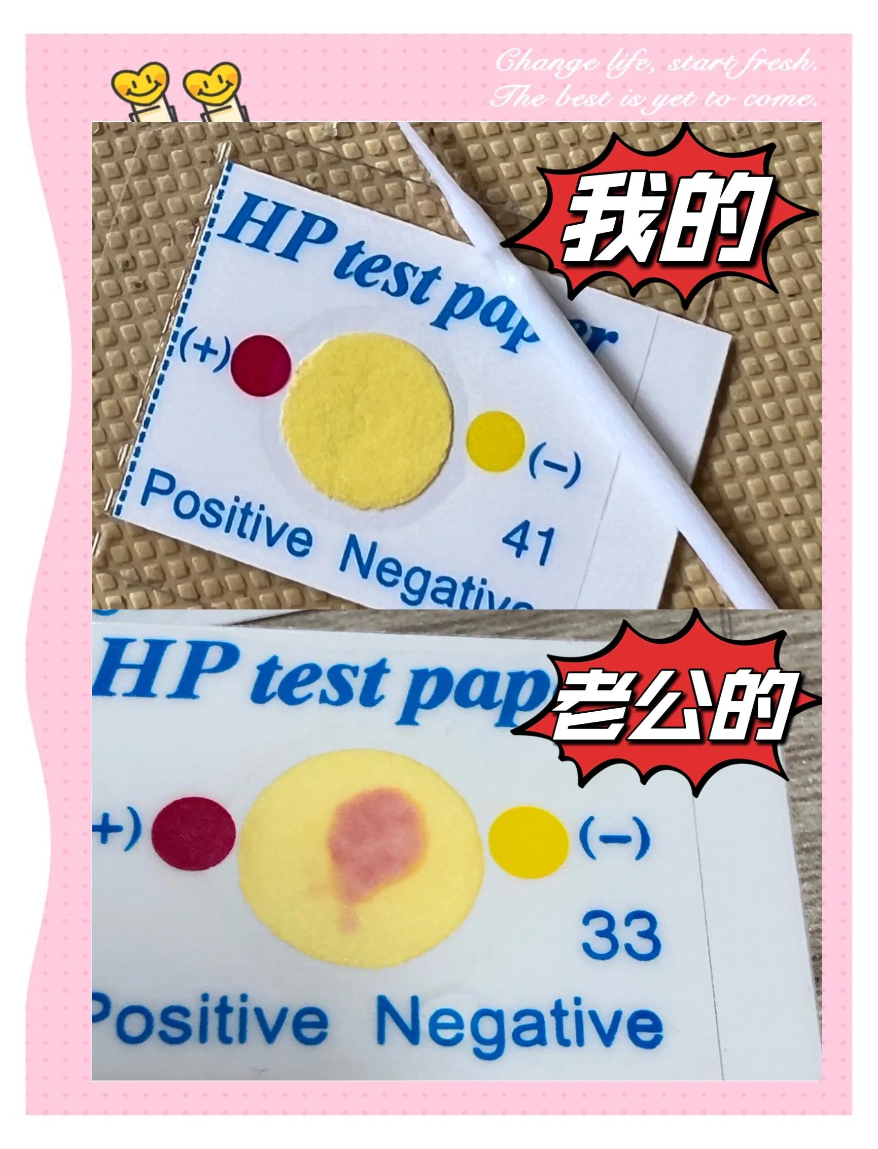 幽门螺旋杆菌检测指标