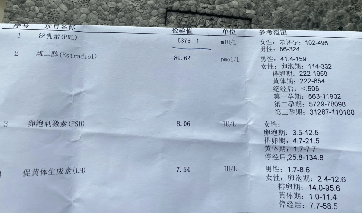 什么是催乳素偏高