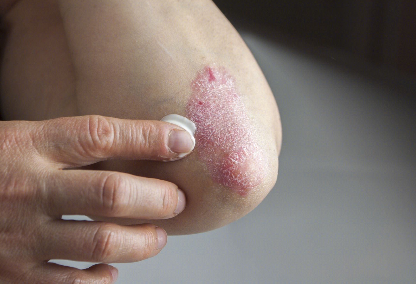 h7n9初期症状表现有哪些