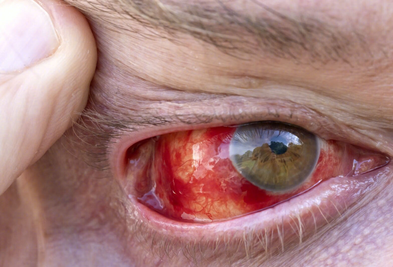 常见的洋地黄中毒表现