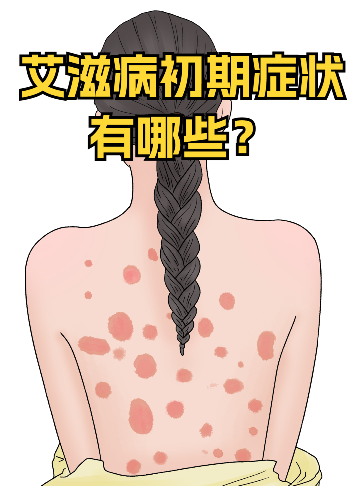 恐艾症有哪些症状