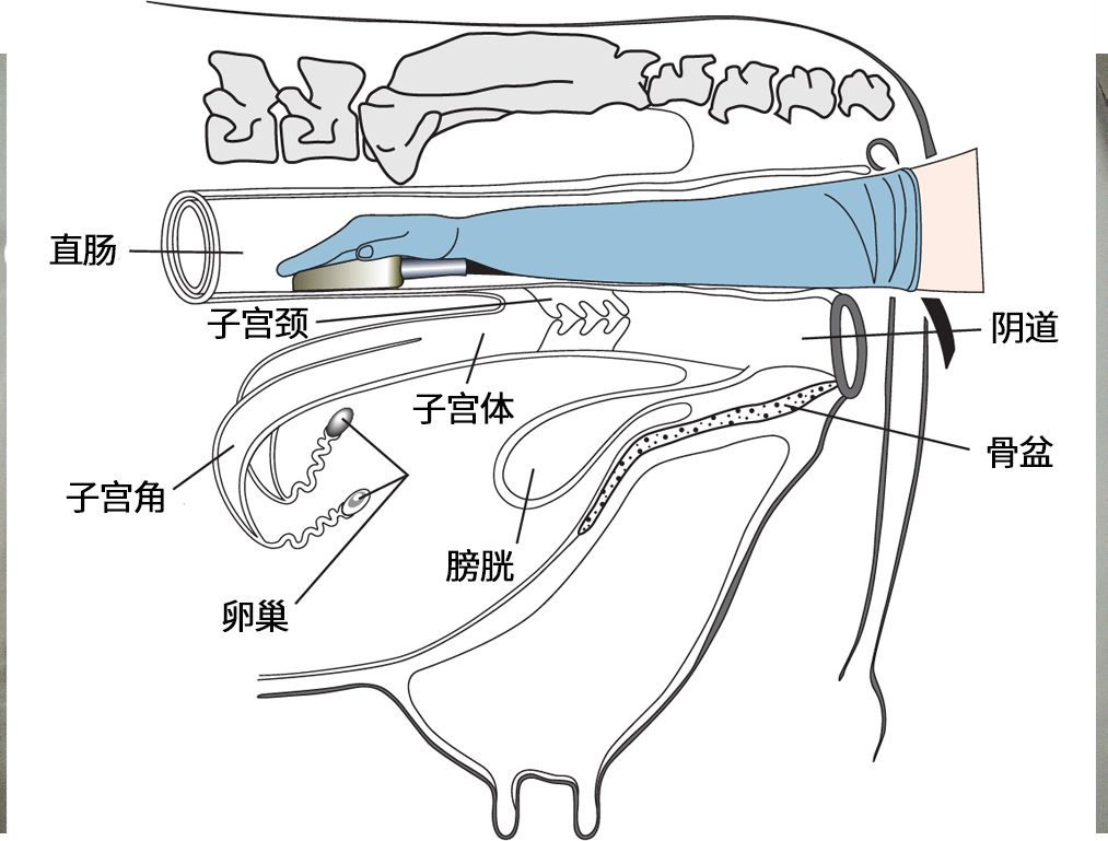 阴道B超是检查什么的