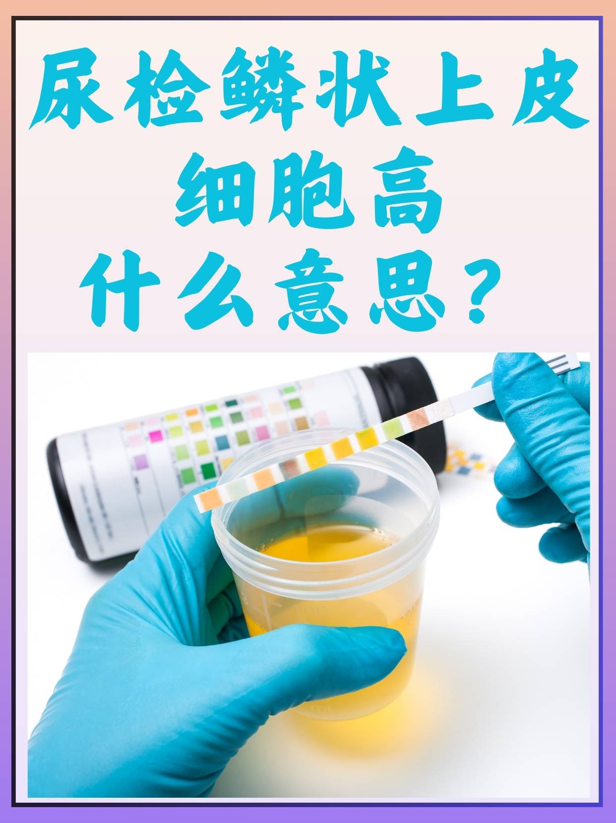 上皮细胞偏高是怎么回事