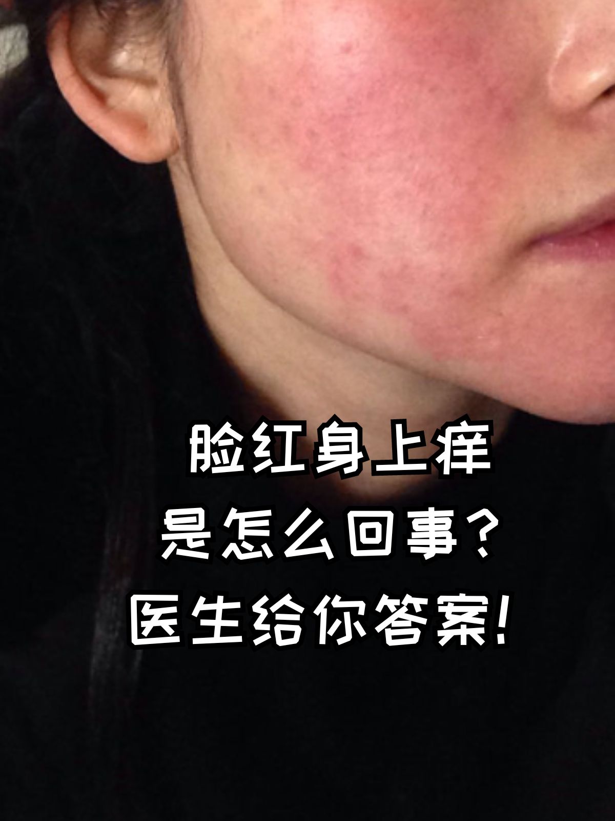 脸红发热是怎么回事