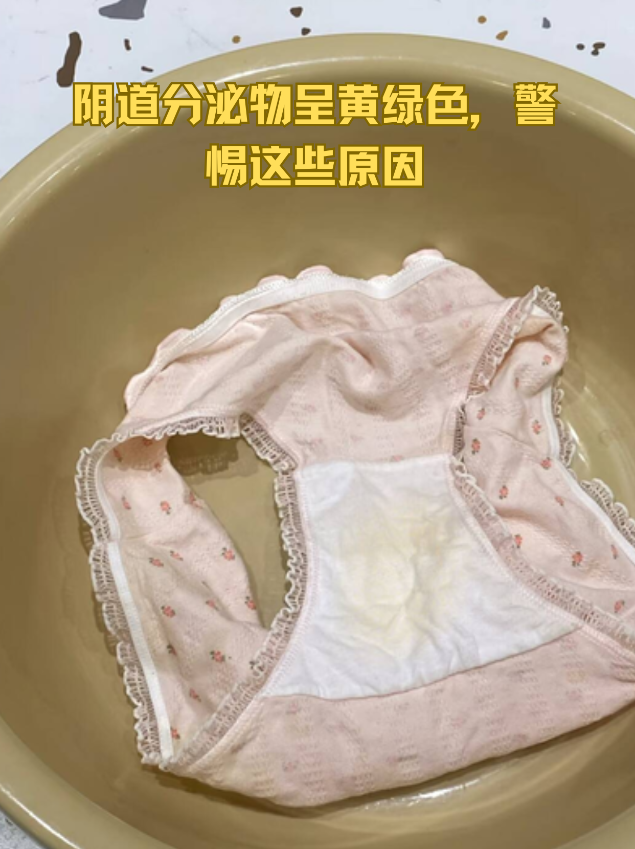 白带象水一样正常吗?