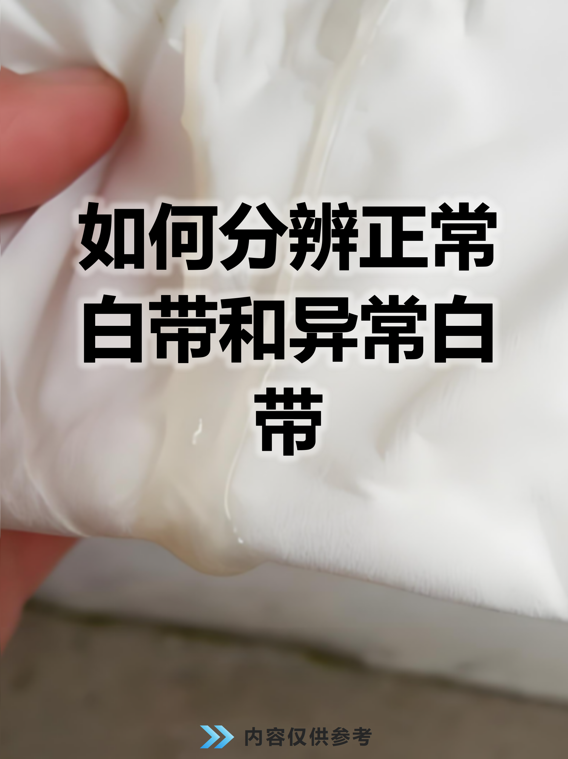 白带象水一样正常吗?
