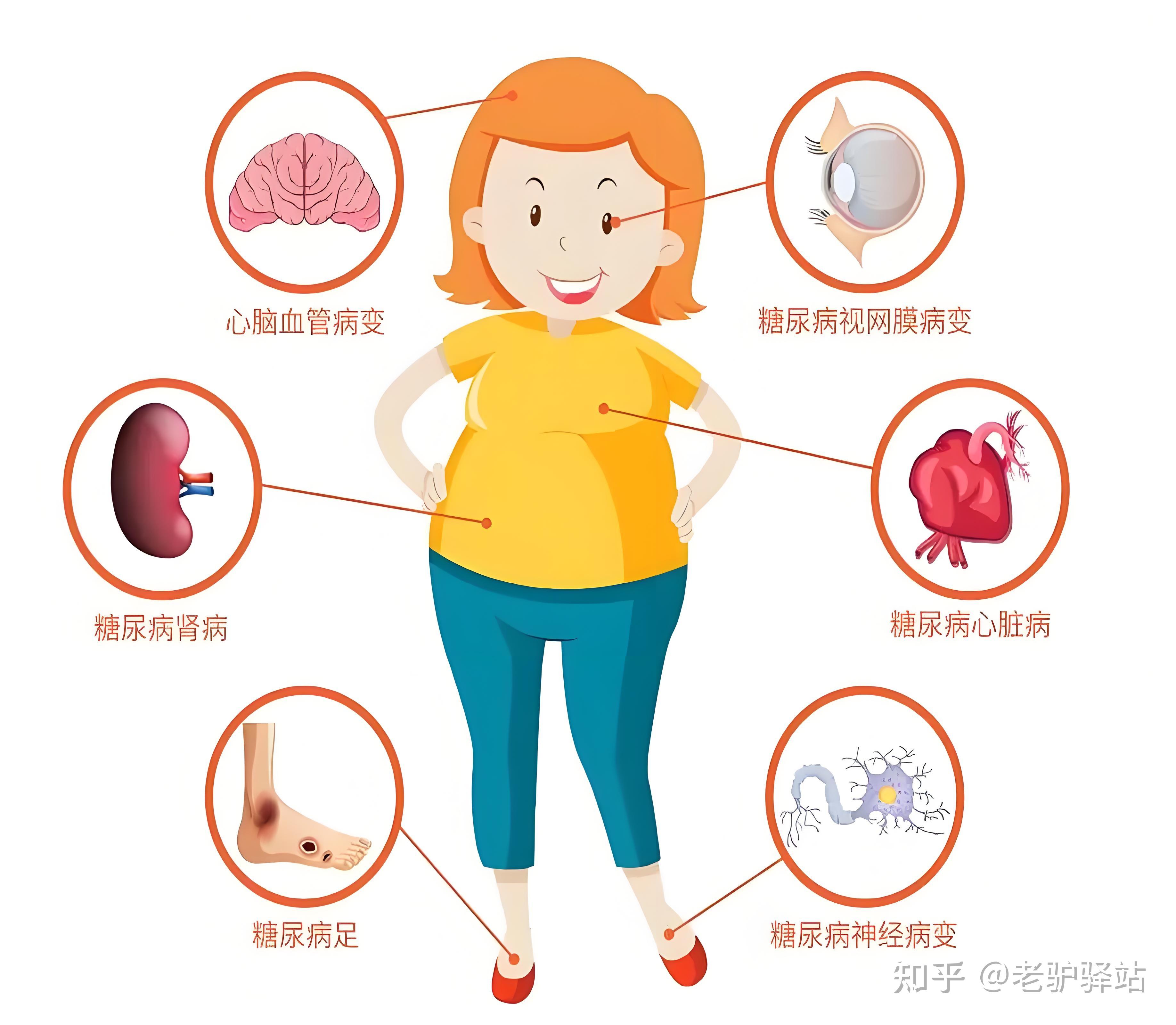 妊娠糖尿病对胎儿的影响