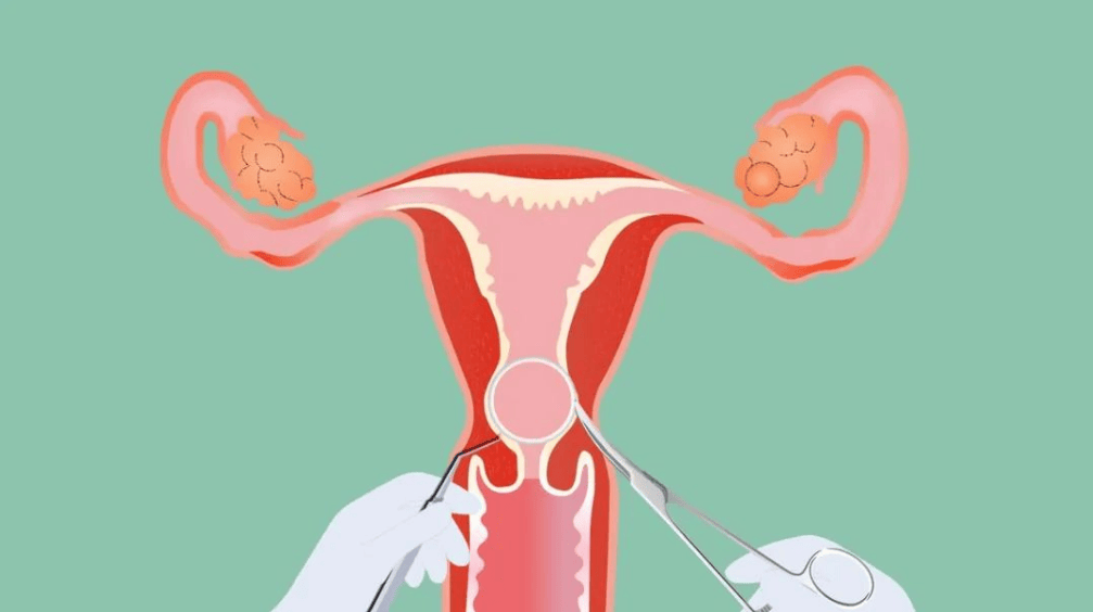 和老公房事的时候,他的手指伸进我阴道里抠了好久,那样有些舒服