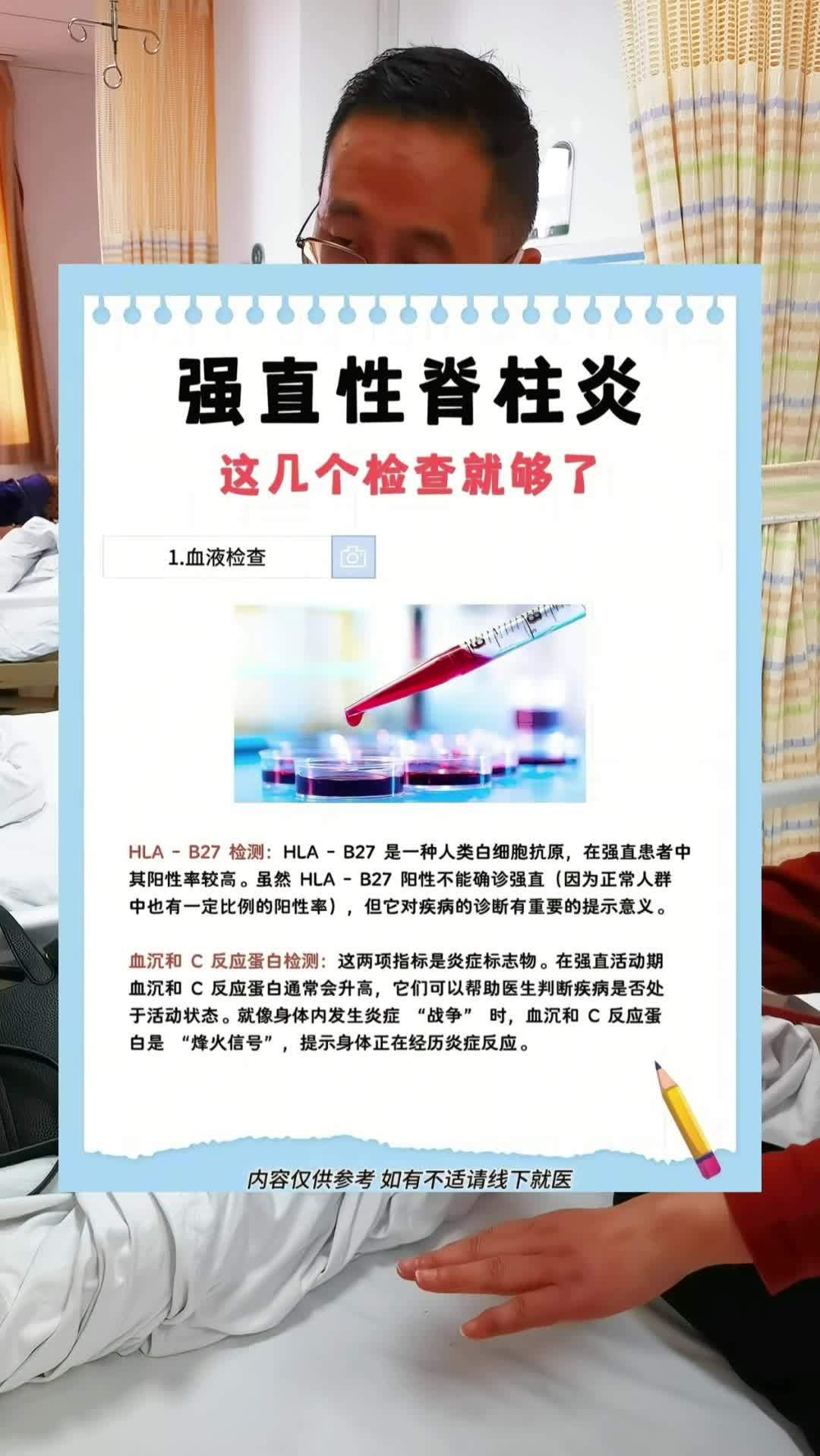 强直性脊椎炎能活多久