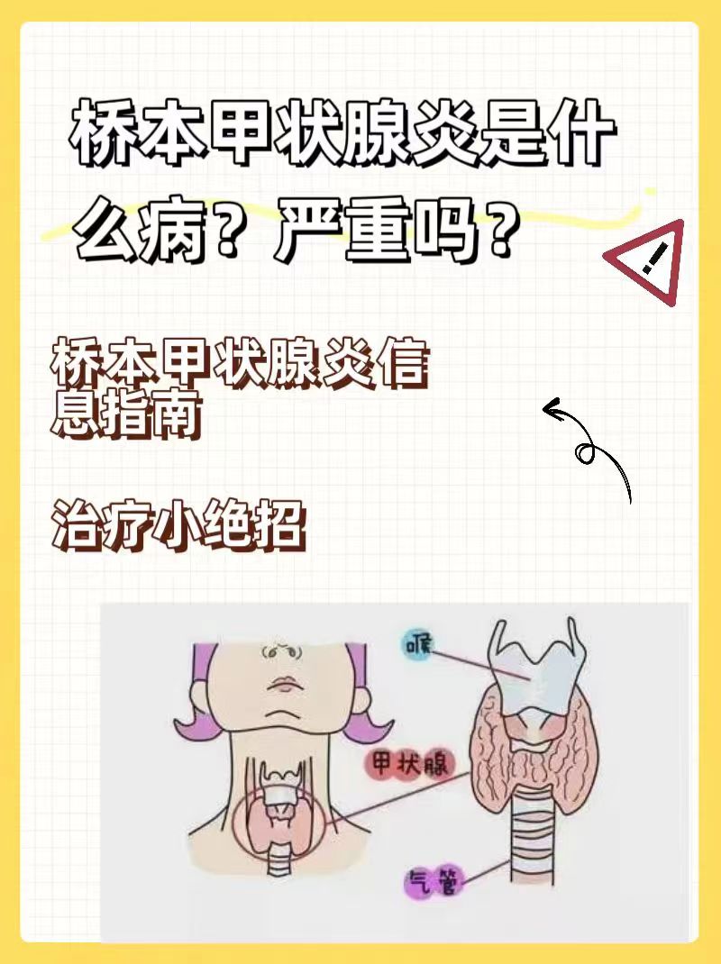 桥本甲状腺炎可以治愈吗