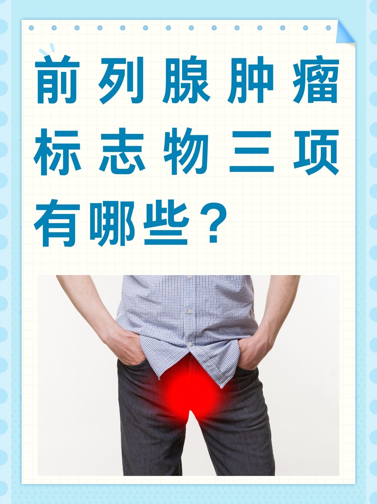 前列腺癌的初期症状