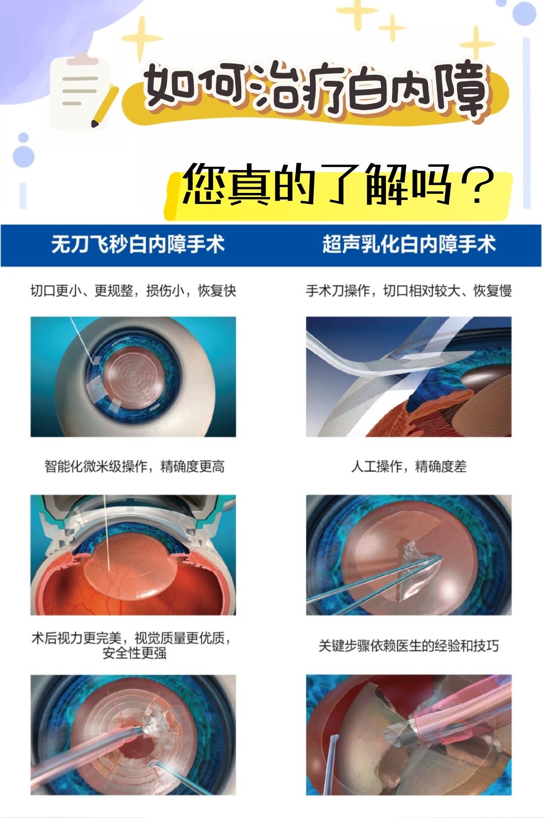做了白内障手术还会复发吗