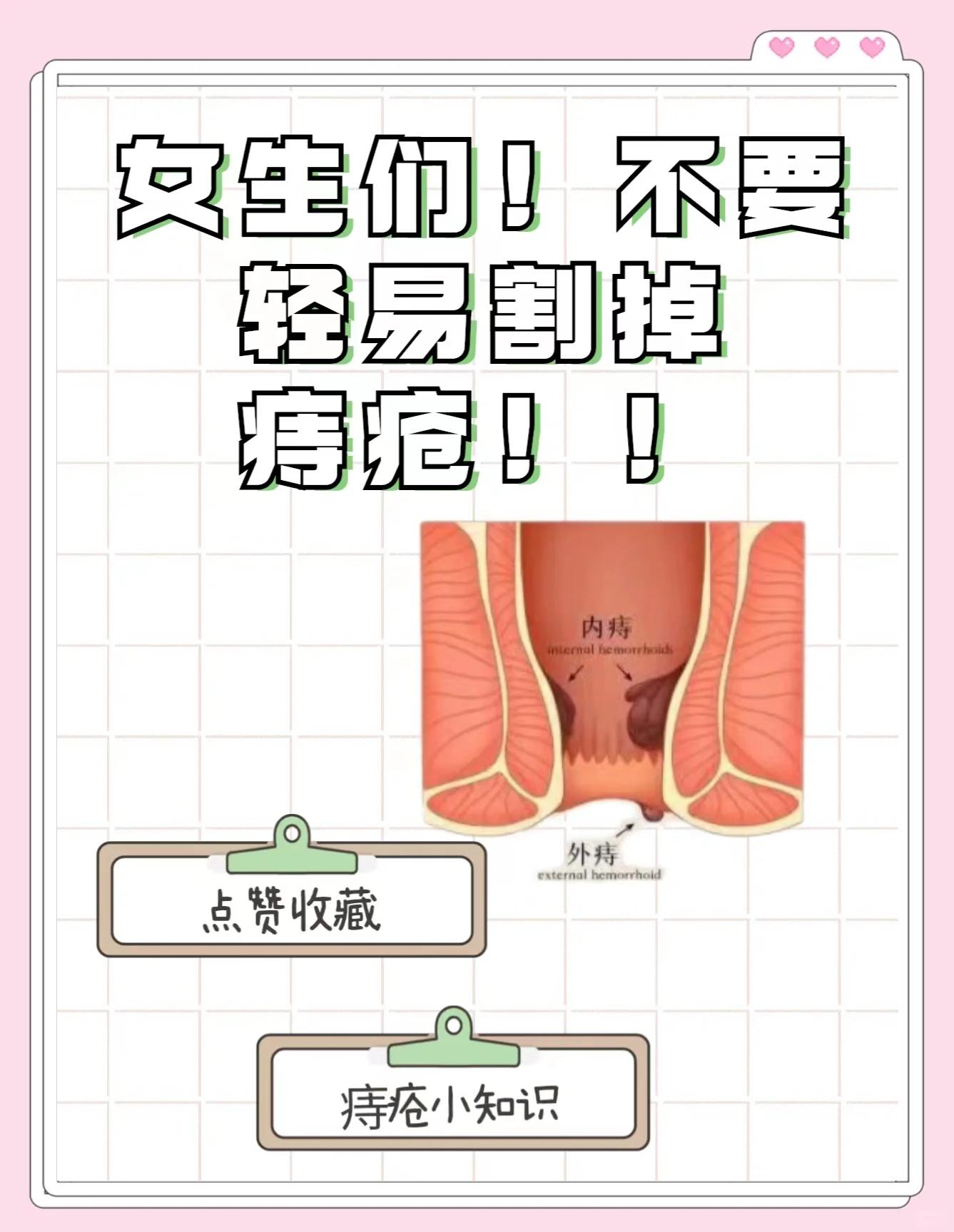 痔疮脱出怎么治疗