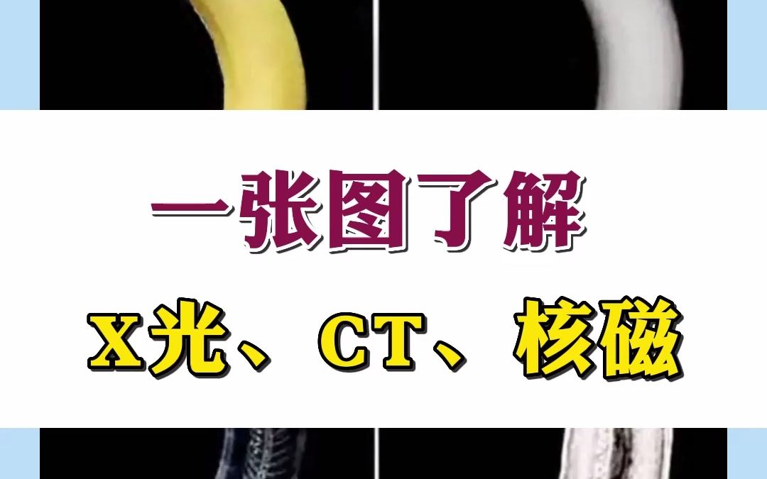 核磁共振和ct有什么区别