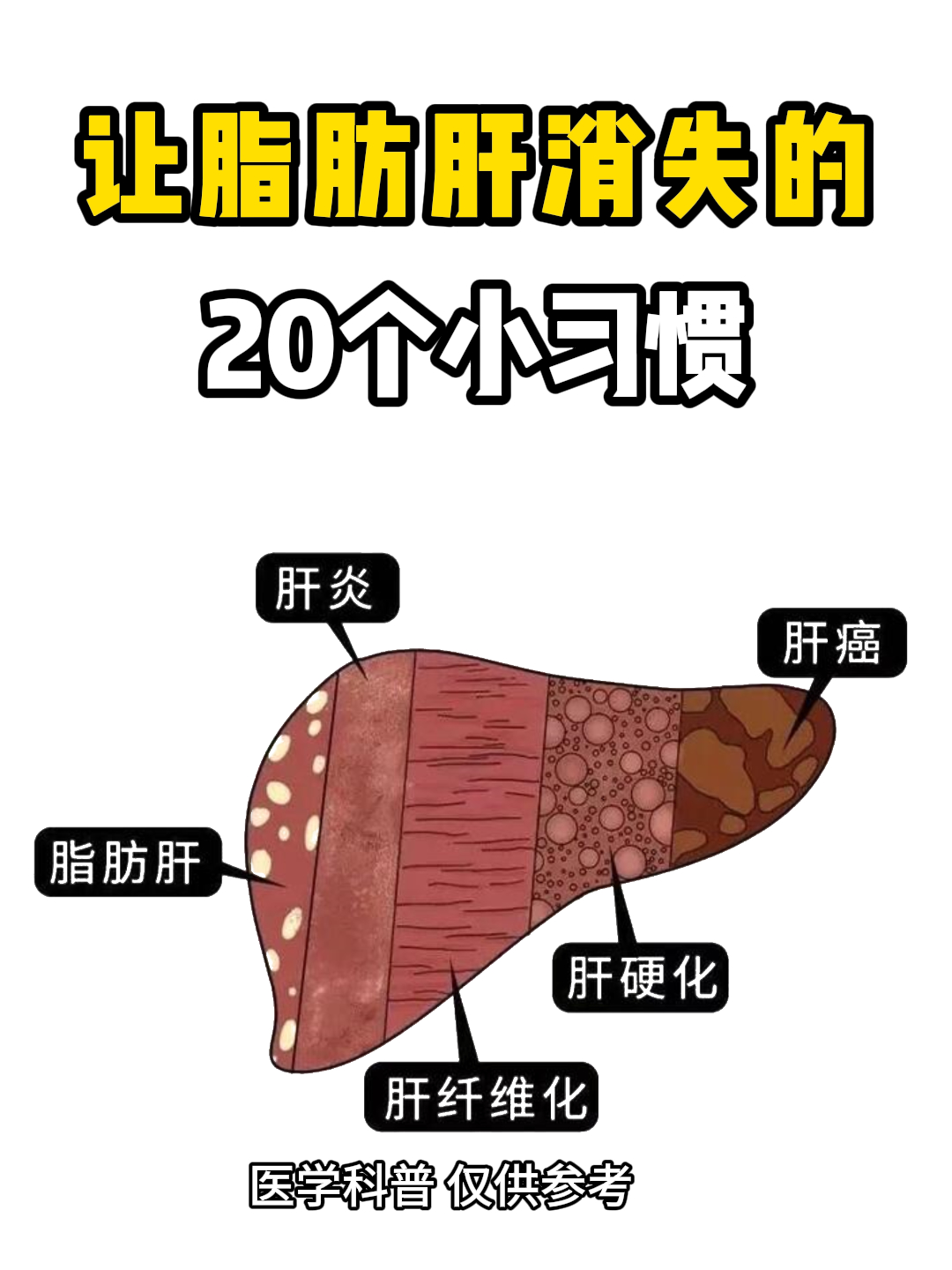 脂肪肝是怎么引起的