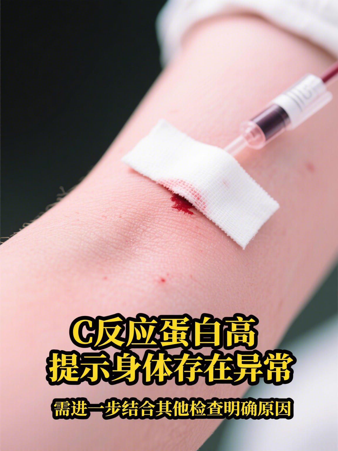 c反应蛋白增高怎么办