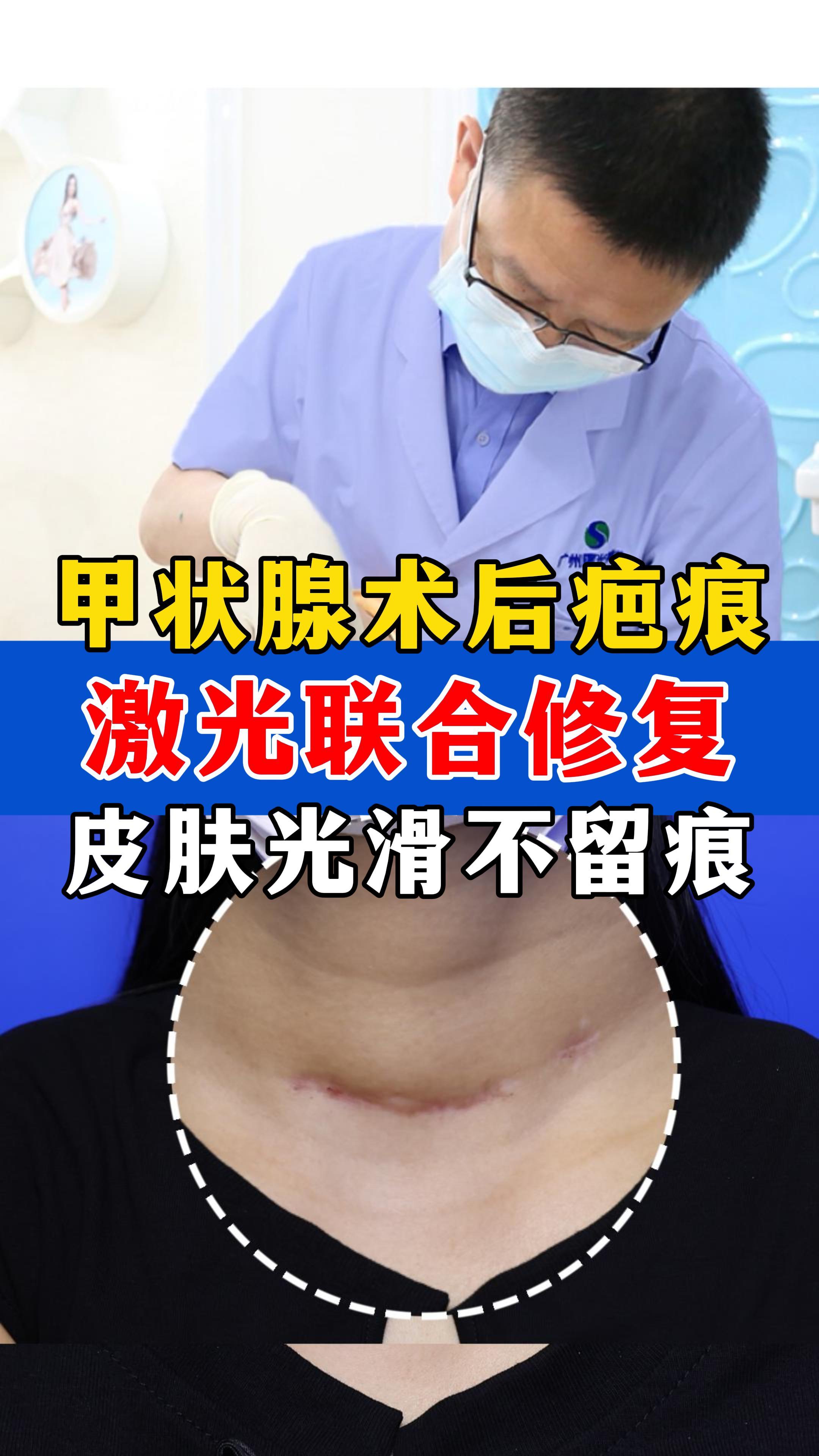 甲状腺手术后多久恢复