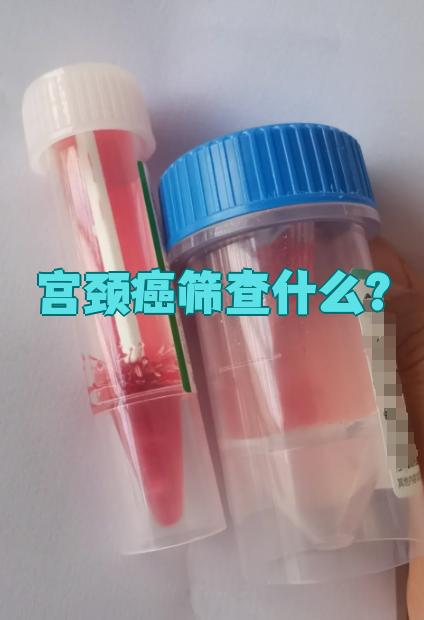 妇科检查TCT是什么