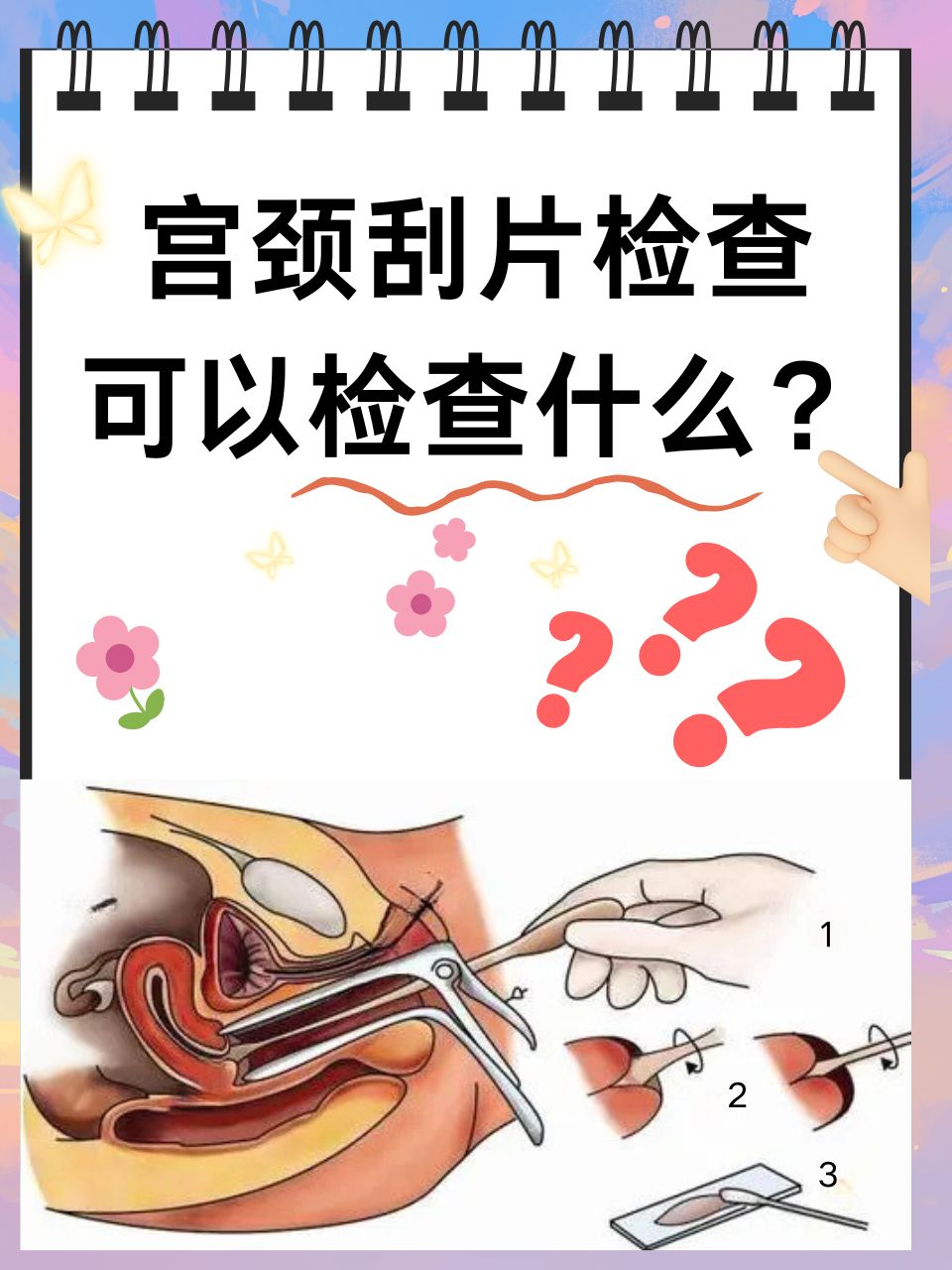 妇科检查TCT是什么
