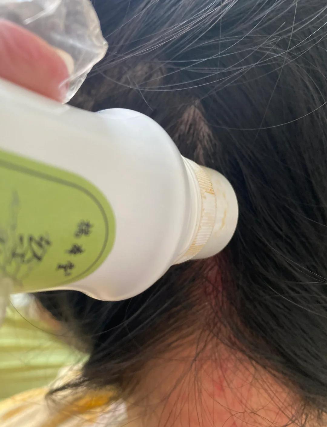 左边后脑勺一阵阵疼怎么回事