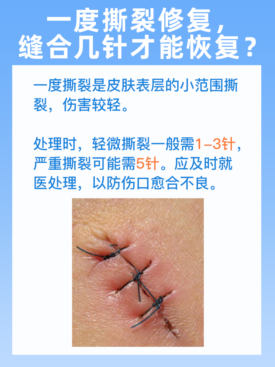 一个小伤口多久就完全愈合了