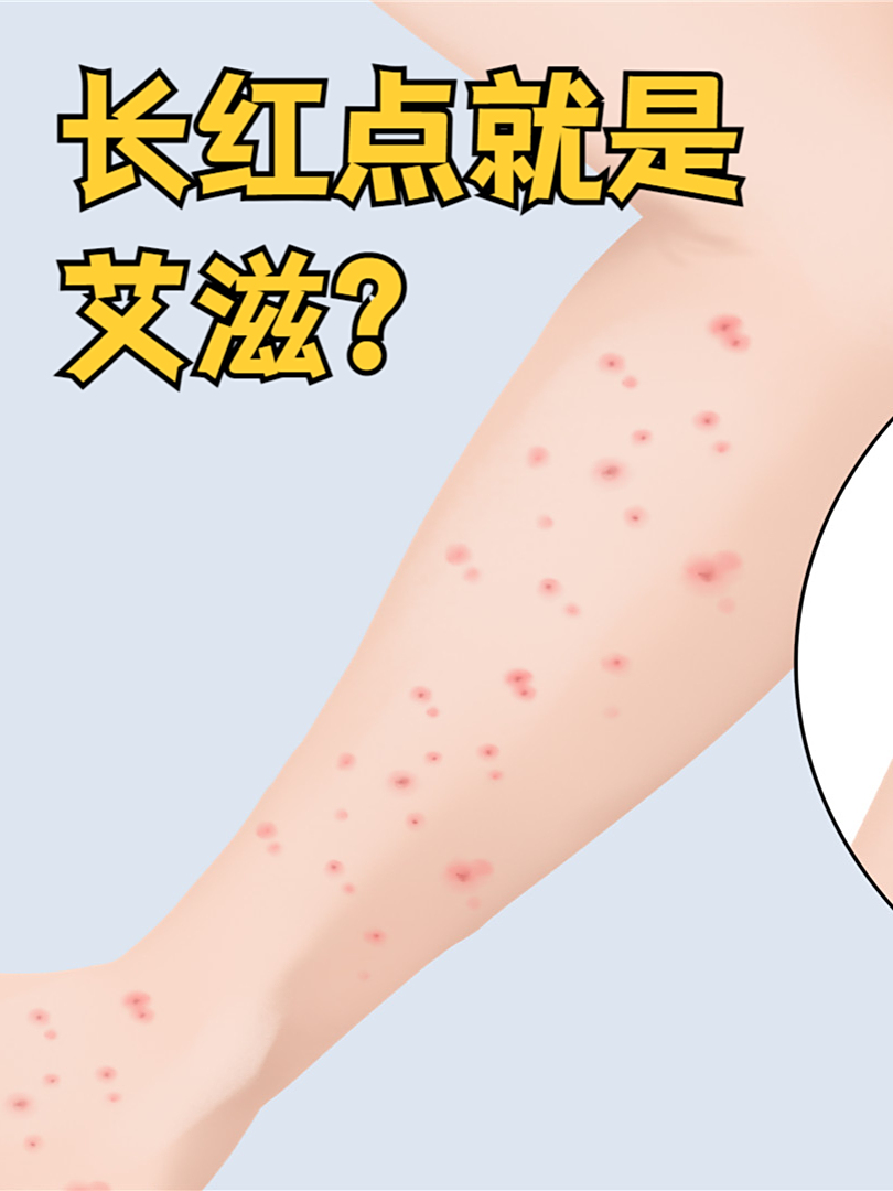 身上起小红点是艾滋病吗