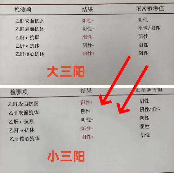 抗-HBS阳性代表什么?