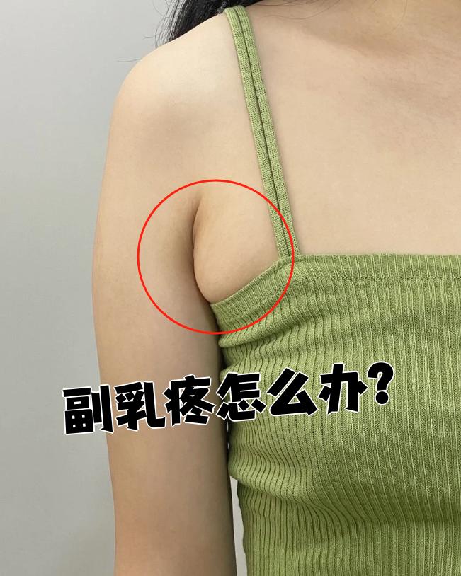 副乳疼怎么回事