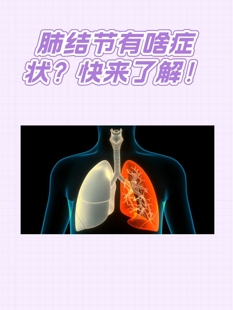 肺病的症状有哪些