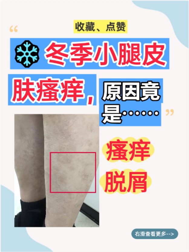 大腿根部瘙痒是什么原因?