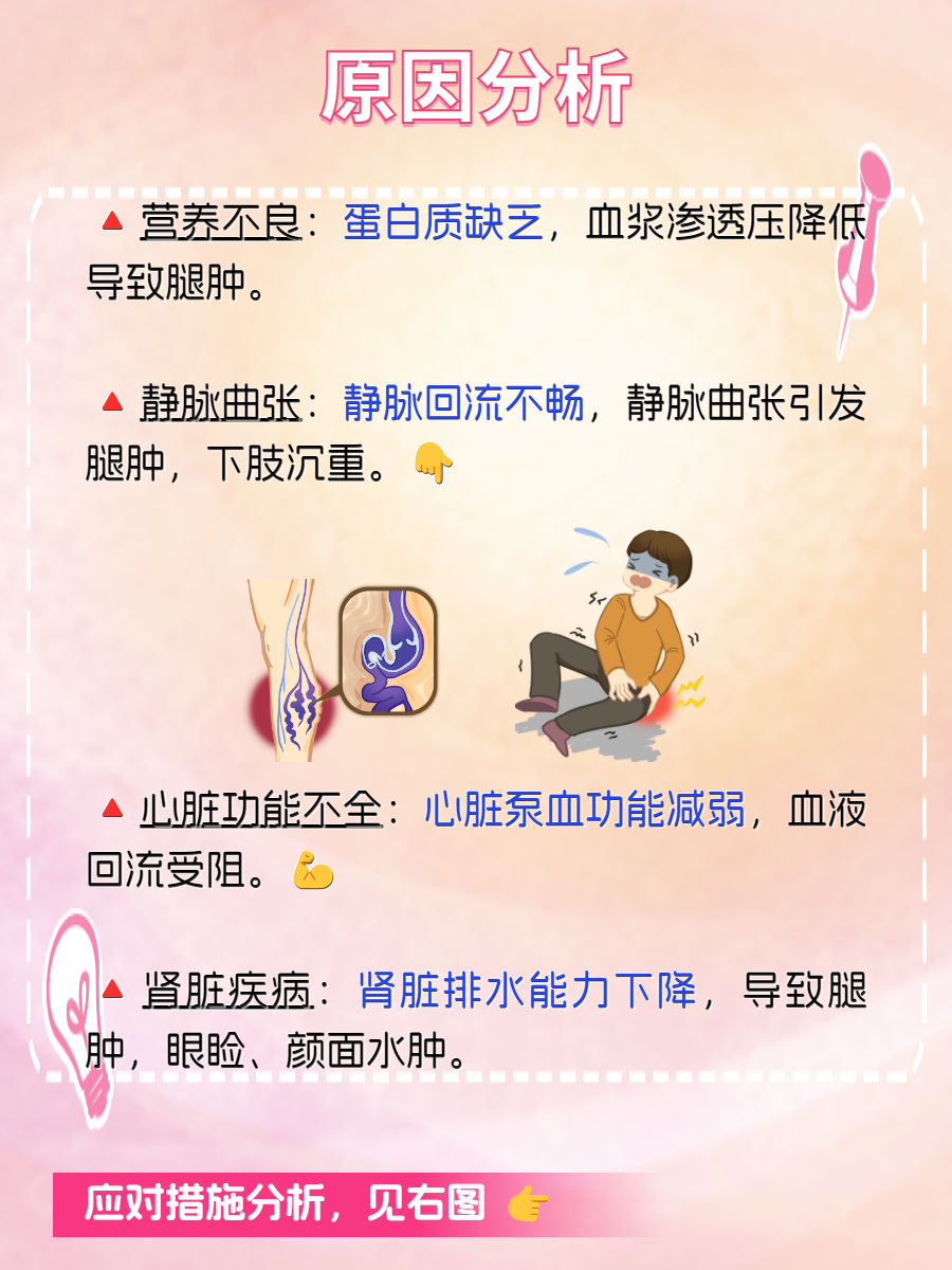 身体浮肿是什么原因造成的