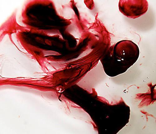 月经颜色暗红色怎么回事?