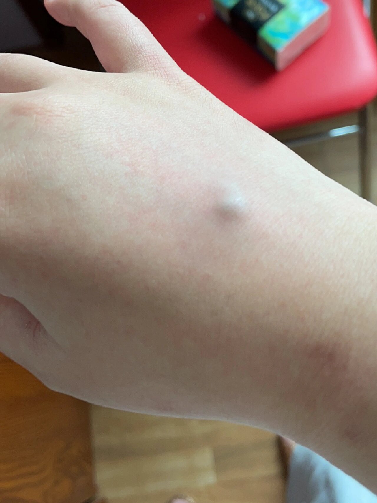 手背上长了个硬疙瘩