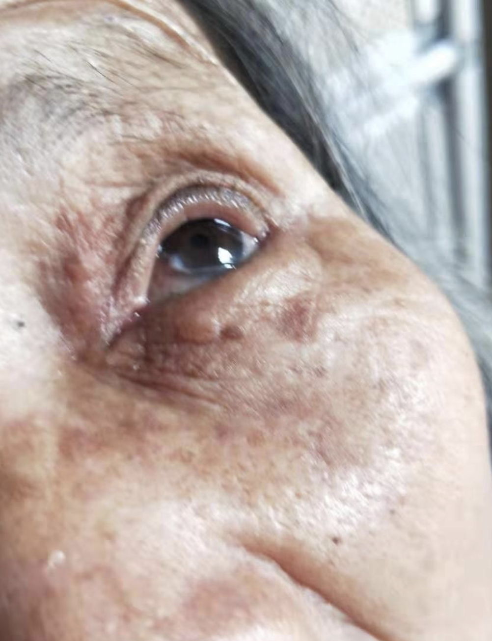 眼睛看东西有重影是怎么回事