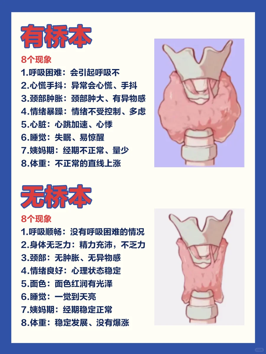 桥本氏甲状腺炎是什么意思?