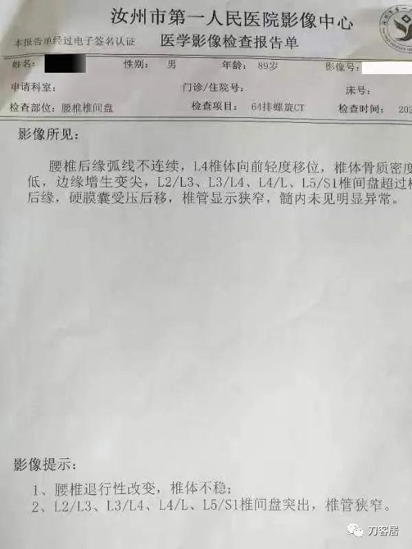 腰椎ct价格一般要多少