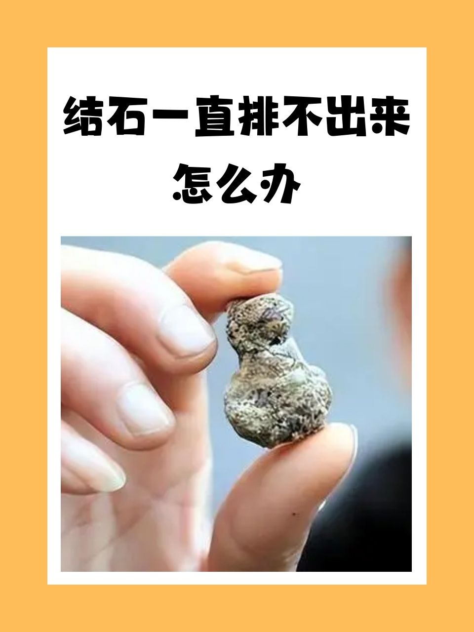 结石是怎么形成的