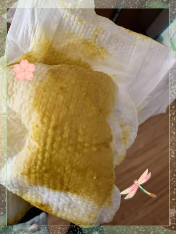 婴儿拉稀怎么回事