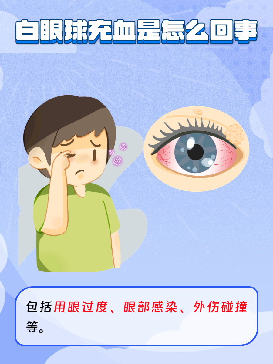 白眼球充血是什么原因