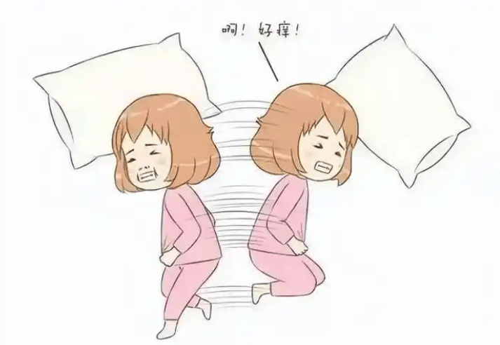 孕妇外阴瘙痒怎么缓解?